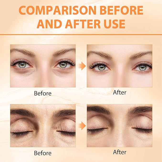 2PCS Revive Glow Vitamin C Eye Balm, Reducing Dark Circle,Hydrating Eye Cream,Improve Dark Circles,Reduces Puffiness (3pcs)