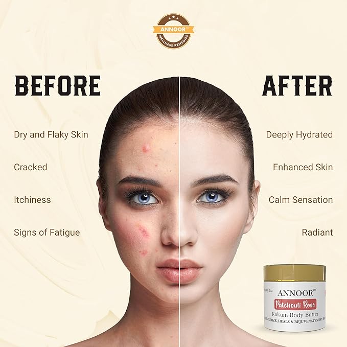 Kokum Patchouli Rose Body Butter Cream | 3 Oz | Enriched with Rose Hydrosol, Kokum Butter, Shea Butter, Almond Oil, Ginger, Vitamin E, and Vitamin B5 | Deeply Hydrating and Softening Cream