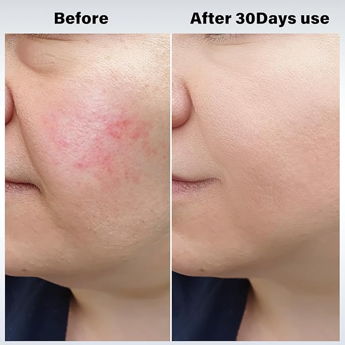 Cool and Hot Facial Firming Device, Light Face Tool with Vibration, Facial Massager with 8-21°C Cold, 38-47°C Hot, Electric Skin Care Kit