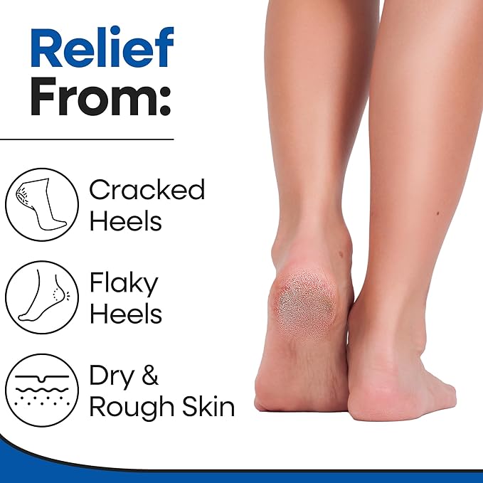 Moisturizing Socks for Men & Women | Cracked Heel Treatment with Aloe Vera | Moisturizer Heel Callus Remover | Aloe Socks for Cracked Heels & Dry Feet | Lotion Gel Sleeves (X-Large - Black)