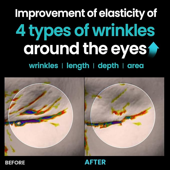 ILSO ER Firming Serum - Retinol 0.1% + Ectoin 1%, Anti-aging & Wrinkle Reducing, Gentle for Sensitive Skin (30ml)