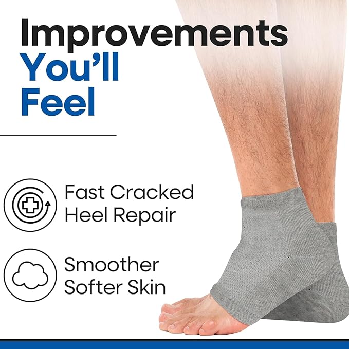 Moisturizing Socks for Men & Women | Aloe Vera Cracked Heel Treatment | Foot Callus Remover | Aloe Socks for Cracked Heels & Dry Feet | Lotion Infused Gel Heel Sleeves (Large - 2 Pairs)