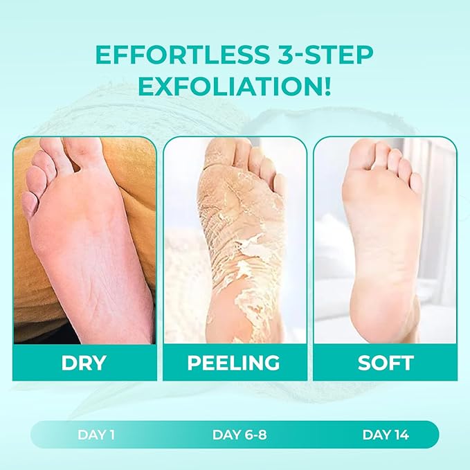 Happy Feet Foot Peel Mask, Original Exfoliate Foot Mask, Callus Remover for Rough Cracked Dry Feet Dead Skin, Coconut 03 Packs