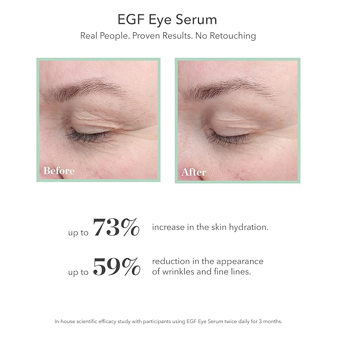 BIOEFFECT EGF Serum, Eye Serum, Eye Mask Skincare Set: Firming Favorites, with Barley Growth Factor