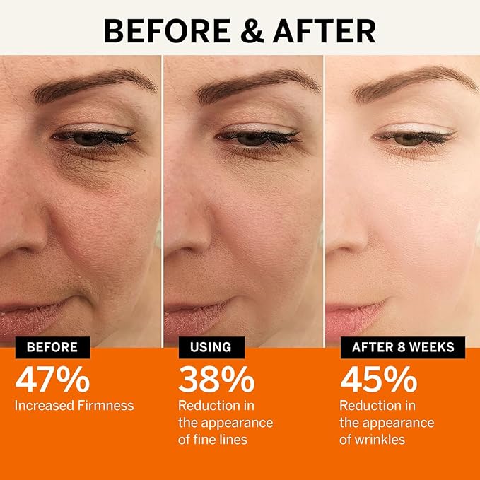 Vitamin C Face Serum: Anti Aging Facial Super Vit C Serum with Ferulic Acid Pure L-Ascorbic Acid, Vitamin E and Hyaluronic Acid for Dark Spots and Skin Care