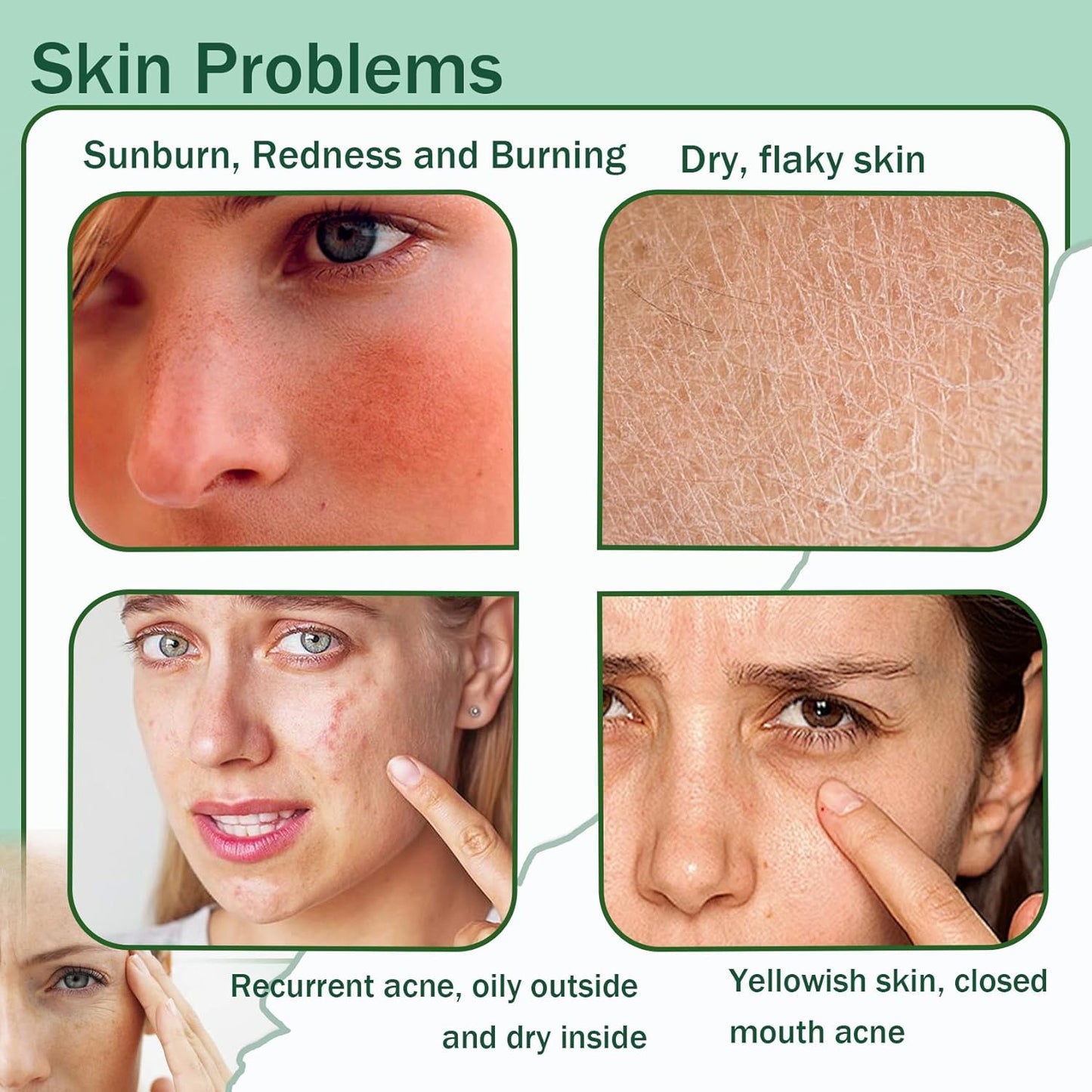 Moisturizing Gel for Face & Body,Non-sticky Gel After Sun Aloe Lotion Skin Care,Fast Absorbing Long Lasting Refreshing Hydrating Face Moisturizer for All Skin Types 05