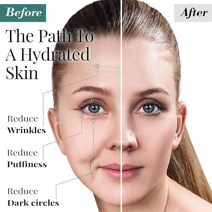 Forehead and Under Eye Wrinkle Patches for Face - Collagen, Hyaluronic Acid and Vitamin A Skin Pads - Forehead Line Remover Wrinkle Eye Patch Set - 26 Caviar Sachets