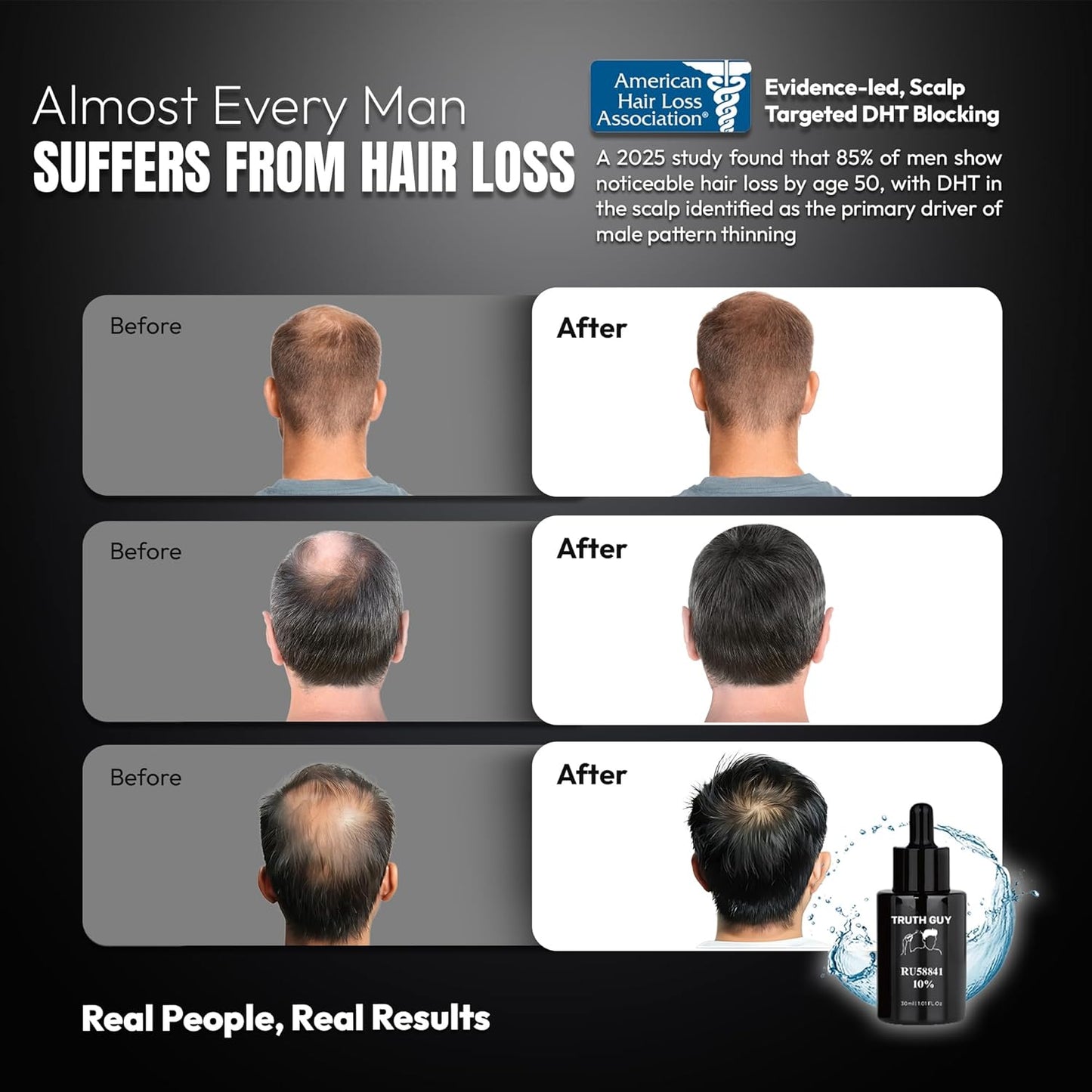 Truth Guy RU58841 10% Hair Serum for Men – Powerful DHT Blocker with Maximum Strength – Targets Male Pattern Thinning and Receding Hairline – Promotes Fuller, Healthier-Looking, Stronger Hair – 30 ml