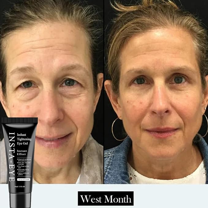 Instant Eye Tightener Cream,Under Eye Tightening Cream for Firm and Smooth the Look of Fine Lines,Reduces Dark Circles, Bags, Puffiness and Fine Lines,Instant Firm Face Tightener(30ml)