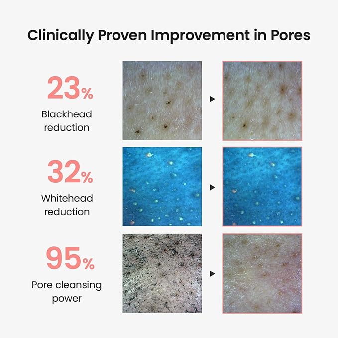 BIODANCE Collagen Cleansing Oil, Facial Oil Cleanser, Gentle Makeup Remover without Clogging Pores, Removes Bleackhed and Whitehead for Sensitive Skin, Oily Skin, 6.76 fl. oz. (200 ml)