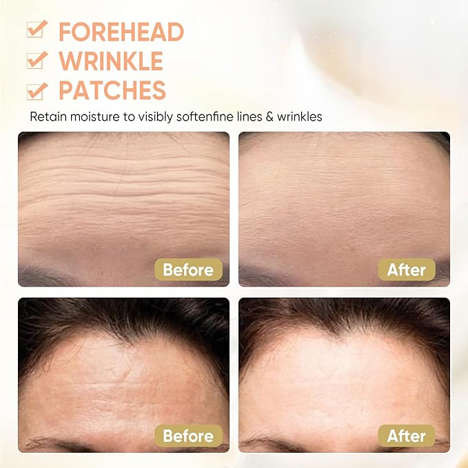 12Pcs Forehead Wrinkle Patches for Women, Hydrolyzed | Collagen | Vitamin E | Aloe Vera to Reduce Wrinkles Forehead Wrinkles Treatment Overnight (Milky white)