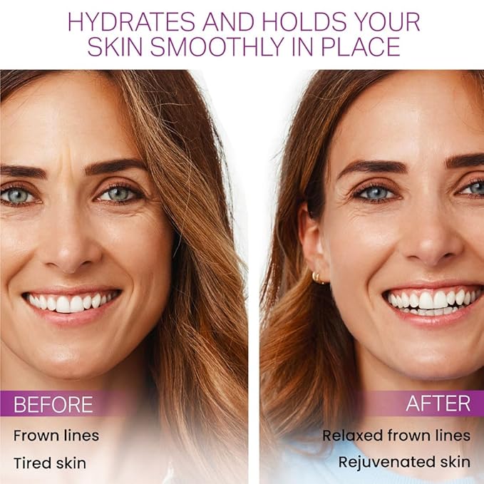 Elevens Wrinkle Patches, Overnight Wrinkle Patches for Frown Lines, Non-Invasive Anti-Wrinkle Patches, Anti-Aging Skincare, 30 Patches, 30-Day Use