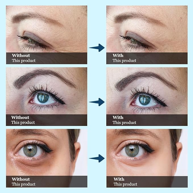 Under Eye Bags and Wrinkles, Wrinkle Filler, Eye Cream Visibly Reduces for Bags Under Eyes Bags Dark Circles Treatment