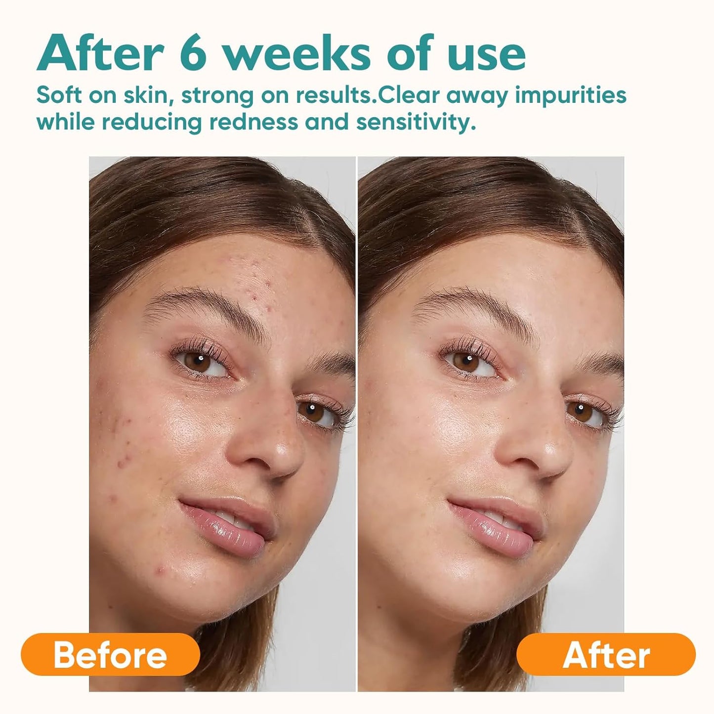 Face Towels, 100 Count Disposable Face Towelette for Washing Face, Skincare, Ultra Soft Facial Towel for Sensitive Skin, Lint-free Makeup Remover Dry Wipes - 2 Box