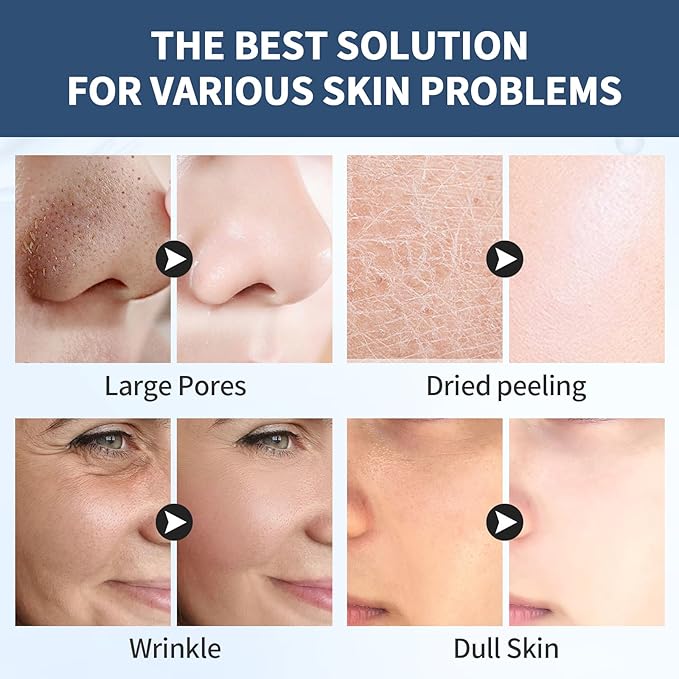 Bio-Collagen Face Masks, Real Deep Collagen Mask, Vitality-Fill Deep Hydrates, Facial Hydrogel Masks | TikTok Trend Items | Korean Skin Care