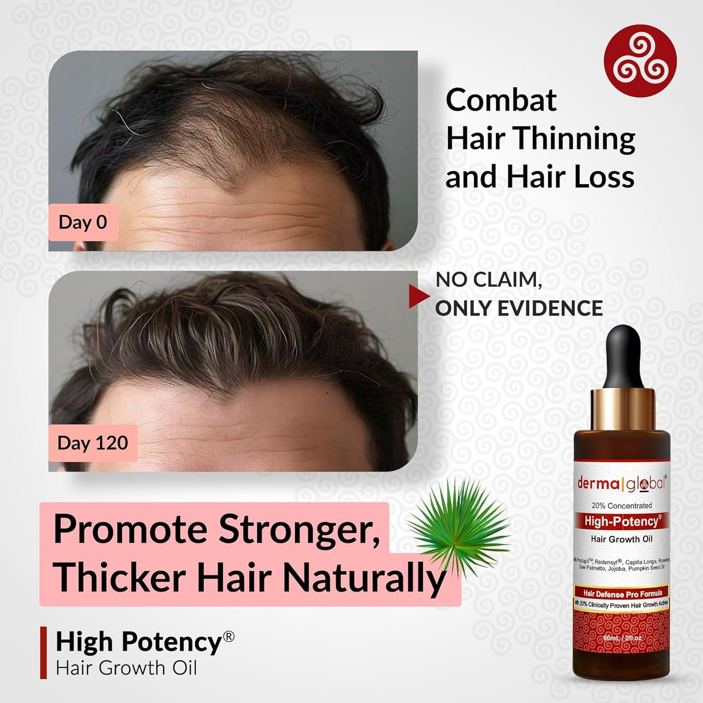 High Potency® Hair Growth Oil – Hair Defence Pro Formula | 20% Clinically Proven Actives including Procapil, Redensyl, Capilia Longa, Rosemary, Saw Palmetto, Jojoba, Pumpkin Seed Oil