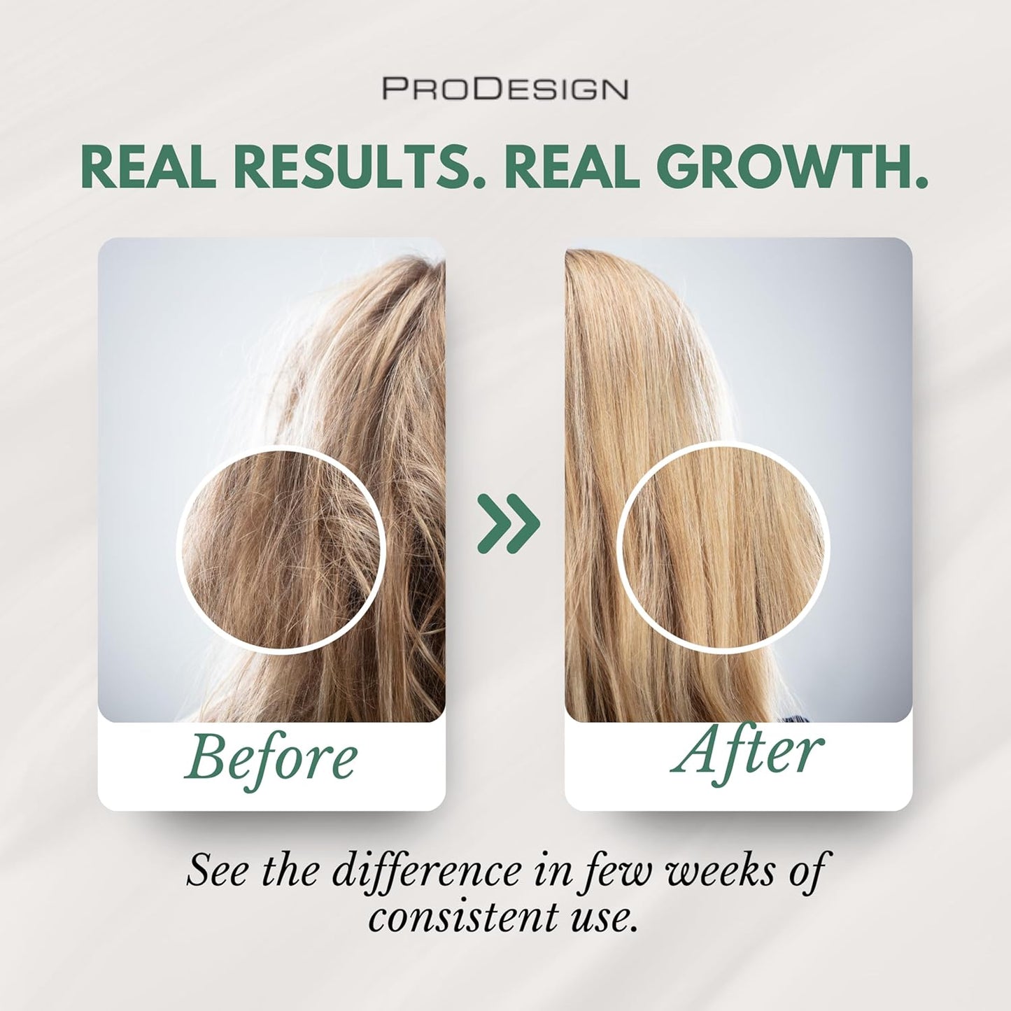 ProDesign Revive TH Thinning Hair Shampoo, Hair Growth Stimulating Formula, 33 oz (Revive Shampoo 33oz)