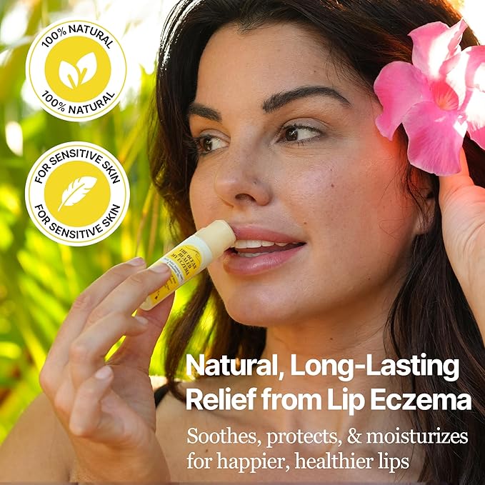 Nourishing & Hydrating Lip Balm - Naturally Soothing Lip Moisturizer for Eczema & Dry Cracked Lips - Moisturizing Lip Care with Mongongo Oil & Manuka Honey (.25 oz)