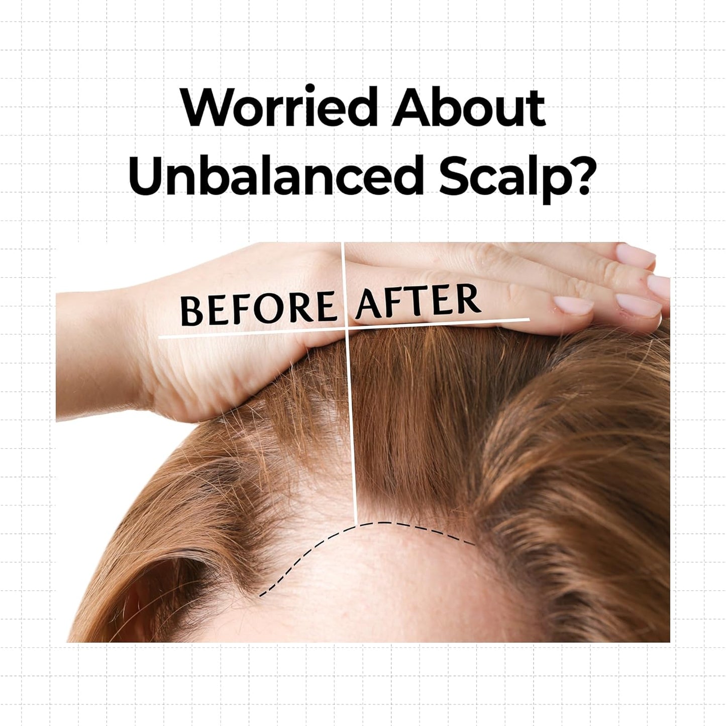 KUNDAL Hair Loss Serum Roll-on 10X Caffeine for Stronger Roots Cooling Menthol & Botanical Hair Regrowth Longevity Korean Scalp Wellness Care For Thinning Hair 0.33 fl oz, Stocking Stuffers