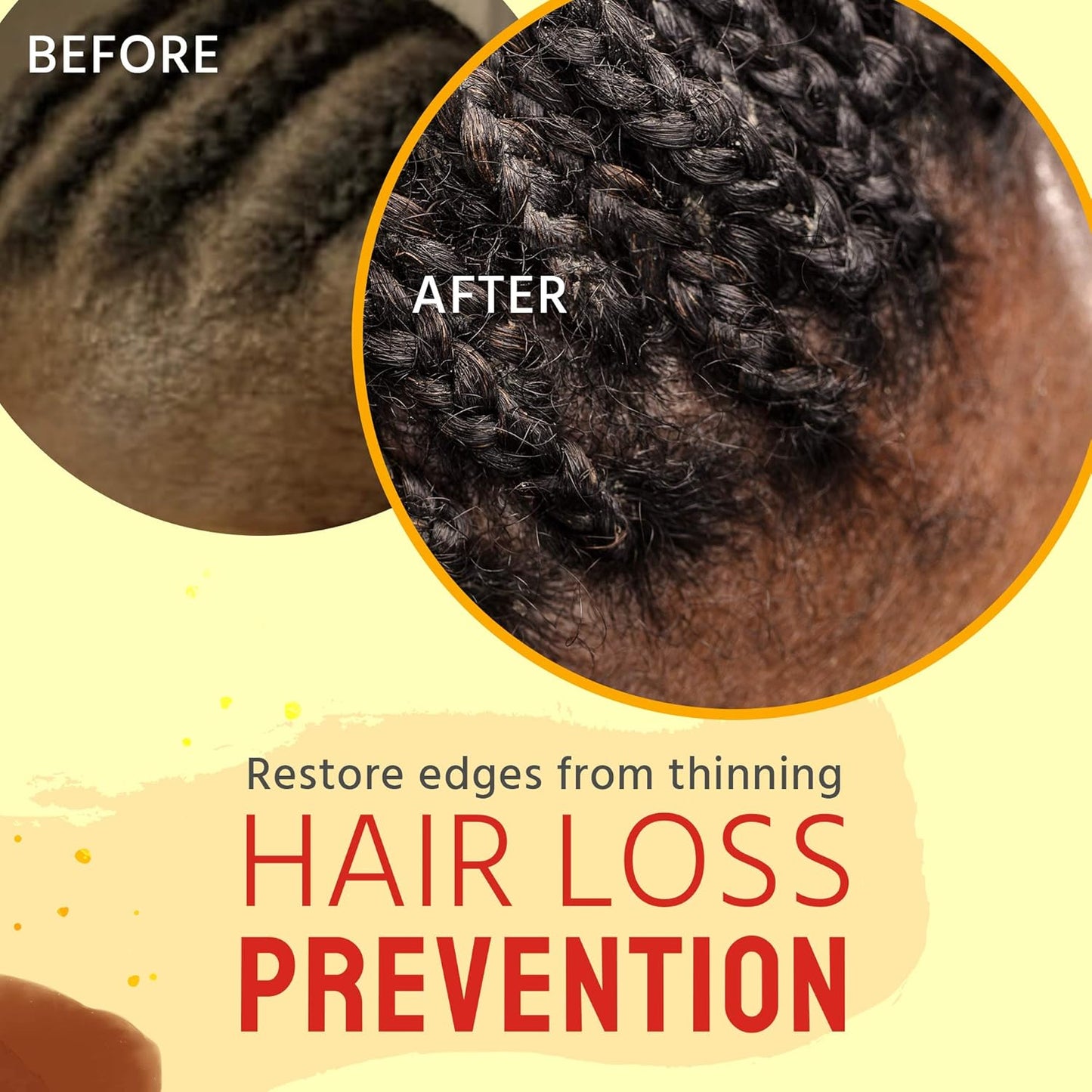 Braid Oil For Dry Scalp and scalp itchiness (8 Oz)