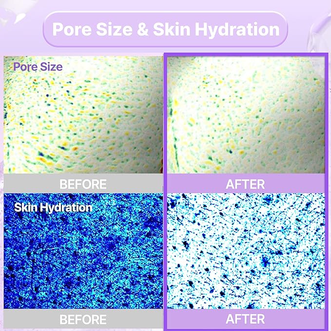 PROBIODERM™ Collagen Remodeling Serum Gel Mask (6ea X 34g) | Hydrogel Mask with Collagen Capsules for Firmness & Pore Refinement | Hydrating Facial Mask for Smoother Skin