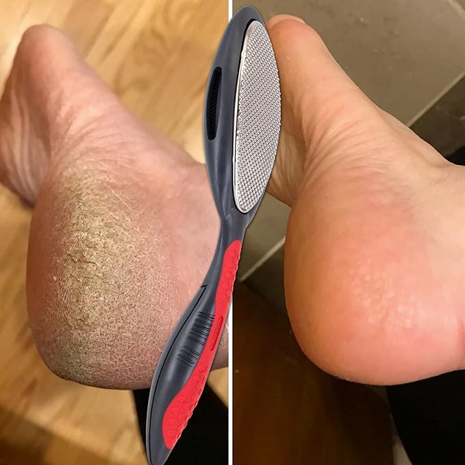 Made in Germany Double Sided Metal Foot File - Stainless Steel Feet Callus Remover - Feet Scrubber Dead Skin - Heel Scraper Cracked Heels Repair Professional Foot Rasp.