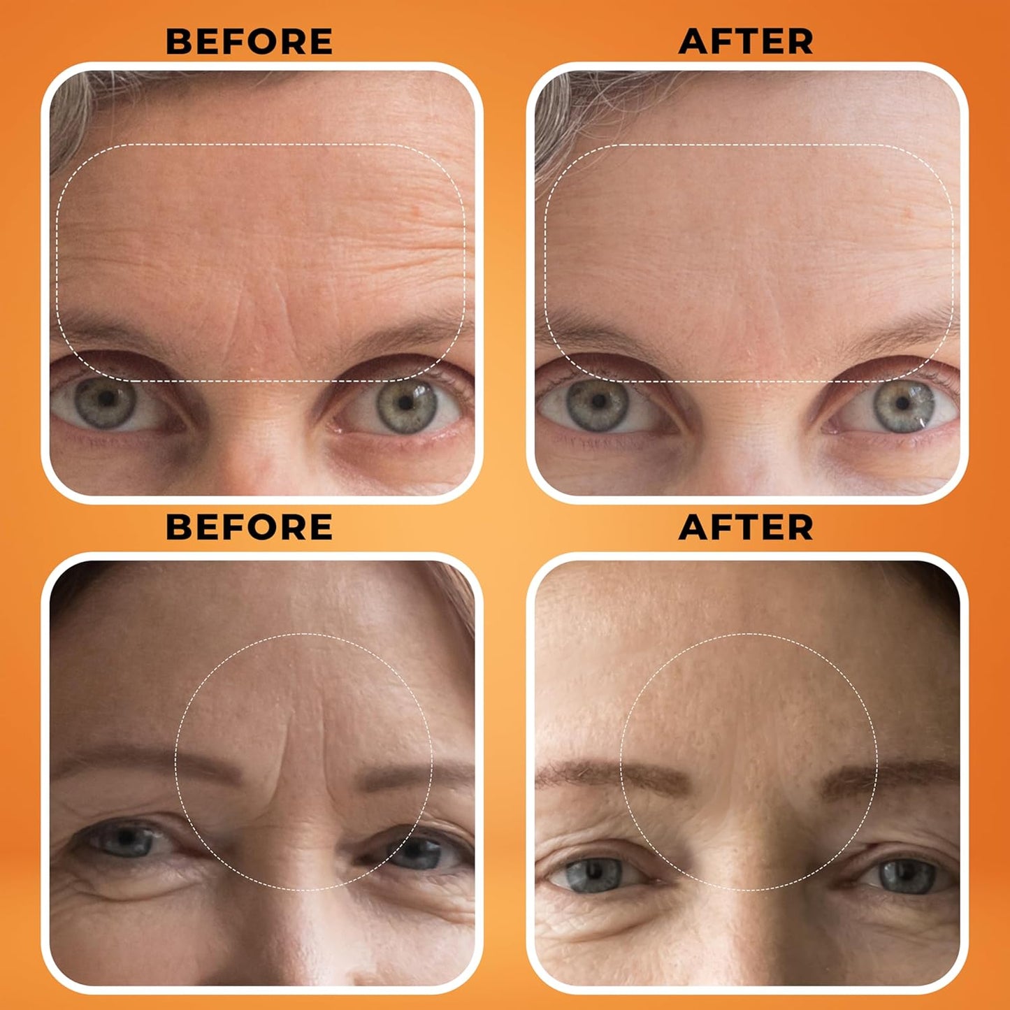 Deep Wrinkle Filler for Face – Collagen-Infused Cream with Birch Tree Sap, Jojoba & Avocado – Targets Fine Lines & Wrinkles – Suitable for All Skin Types – 1.3 fl oz