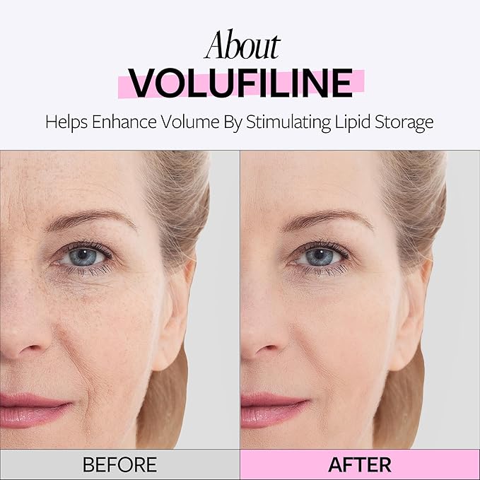 RECIPE Volufiline 100% Ampoule - Pure Volufiline Serum from Sourced from Sederma, France - DIY Skin Care Booster for Face & Body – Hydrating & Age-Defying Formula for Elevated Resilience (0.33 fl oz)