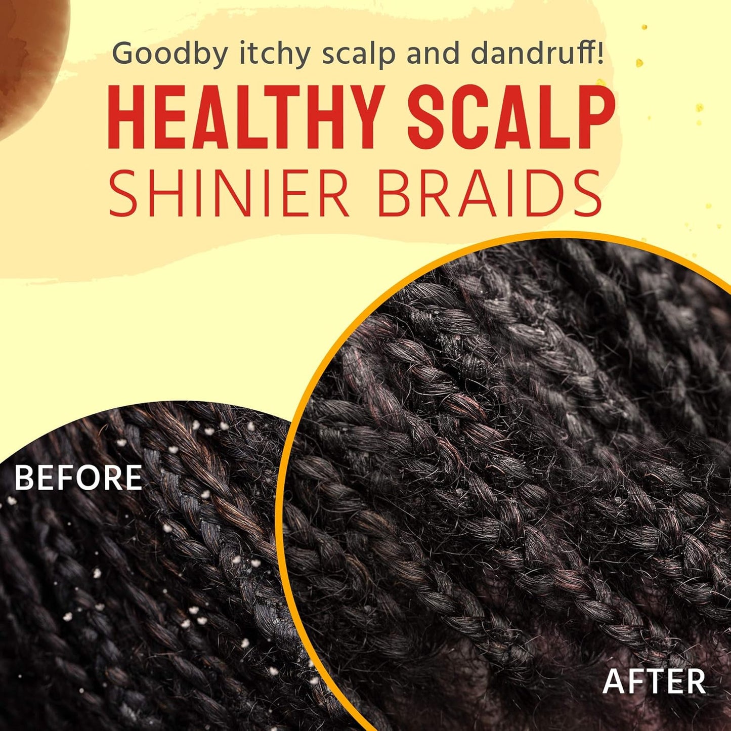 Glammed Naturally Scalp Oil for Dry Itchy Scalp - Includes Castor Oil for Hair, Dandruff, Locs, Tension Relief Hair Oil Applicator for Scalp Care 4 oz