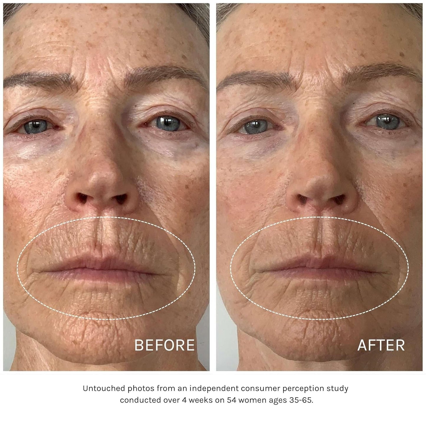 Kari Gran Essential Peptide Serum, Anti-Aging Serum With Matrixyl 3000 OS and 15 Plant Oils (30 ml)