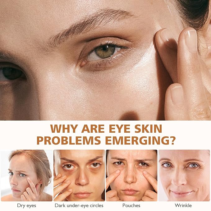 2PCS Revive Glow Vitamin C Eye Balm, Hydrating Eye Cream,Improve Dark Circles,Brightens Skin Tone,Reduces Puffiness