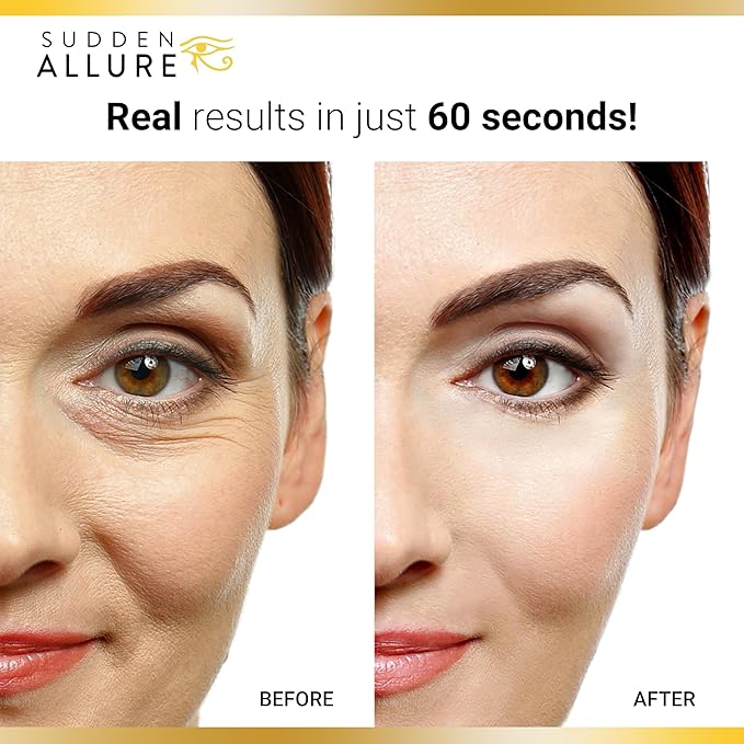 Sudden Allure Instant Under Eye Treatment Serum – Erase Under Eye Bags, Dark Circles, Wrinkles & Lift Sagging Eyes - Instantly Tighten & Firm - Reduce Eye Bags & Crows Feet | Made in USA (10 ml, 2pk)