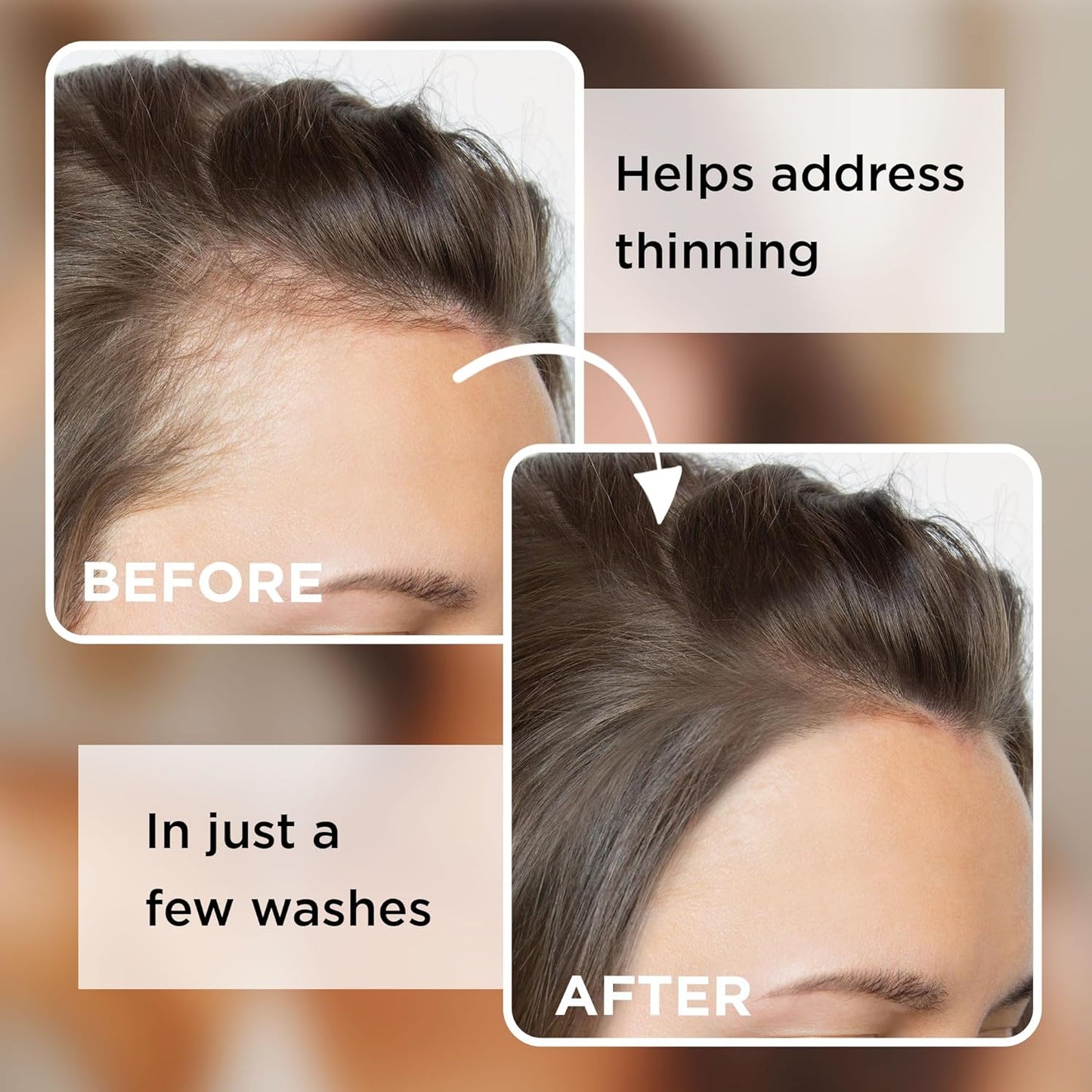 Castor Oil Shampoo Bar - No Added Fragrance - Solid Shampoo for Thinning Hair - Men and Women - 3.5 Oz - Pack of 1