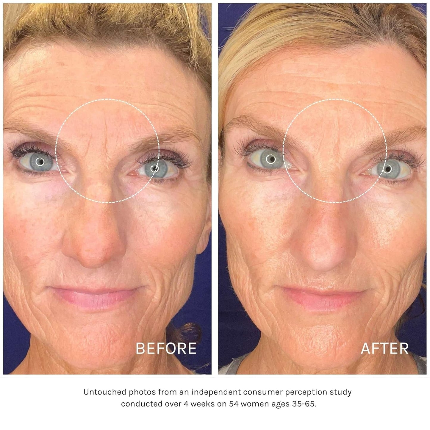 Kari Gran Essential Peptide Serum, Anti-Aging Serum With Matrixyl 3000 OS and 15 Plant Oils (30 ml)