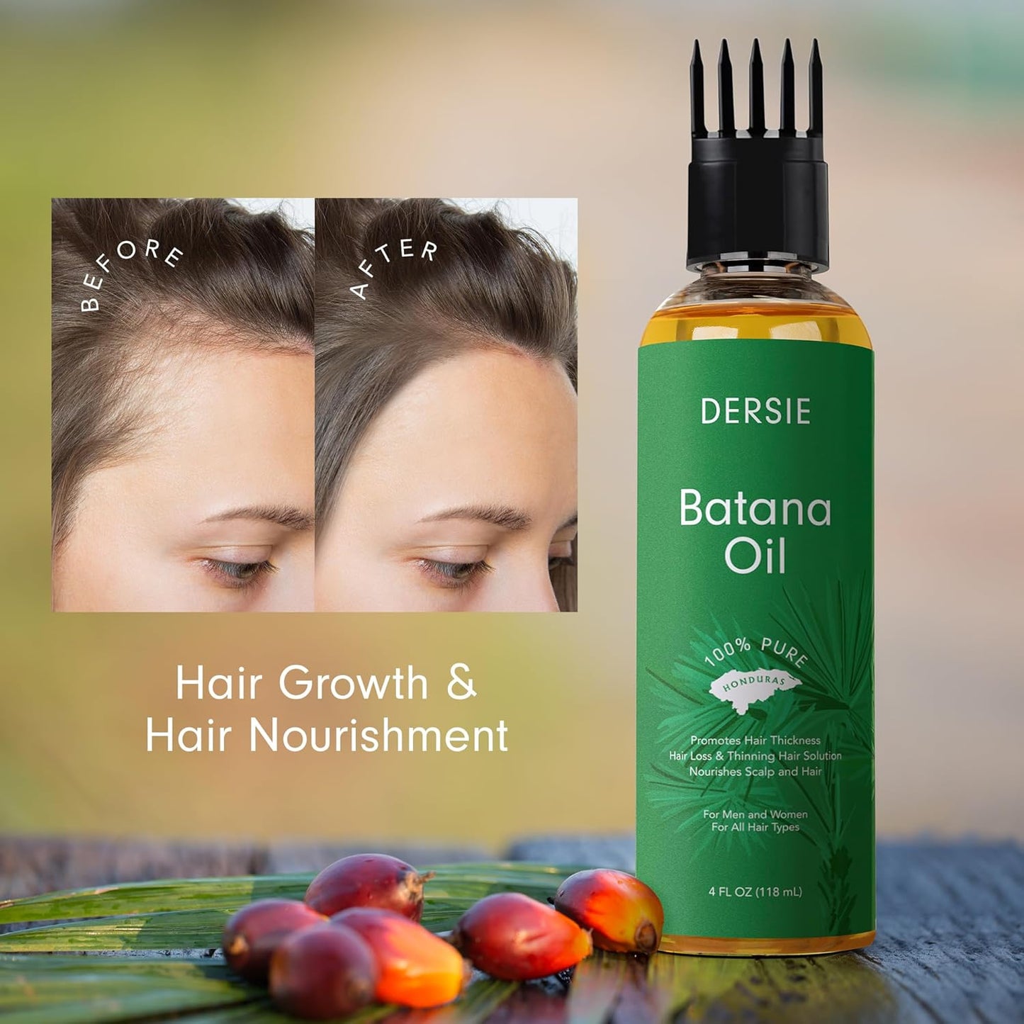 Dersie Batana Oil for Hair Growth: Hair Growth & Nourishment with Massager Applicator – 100% Pure Organic Batana Oil from Honduras, Inspired by Dr Sebi – For Thicker, Longer & Healthier Hair (4 FL OZ)