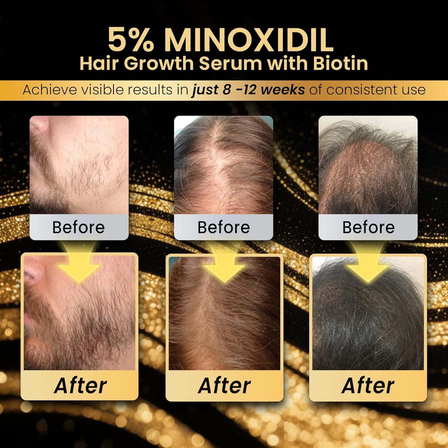 5% Minoxidil Hair Growth for Men and Women, Extra Strength Minoxidil Hair Loss Treatment Serum with Biotin for Faster Stronger Thicker Hair Growth 60ML - For Women Hair, Men Hair & Beard Growth