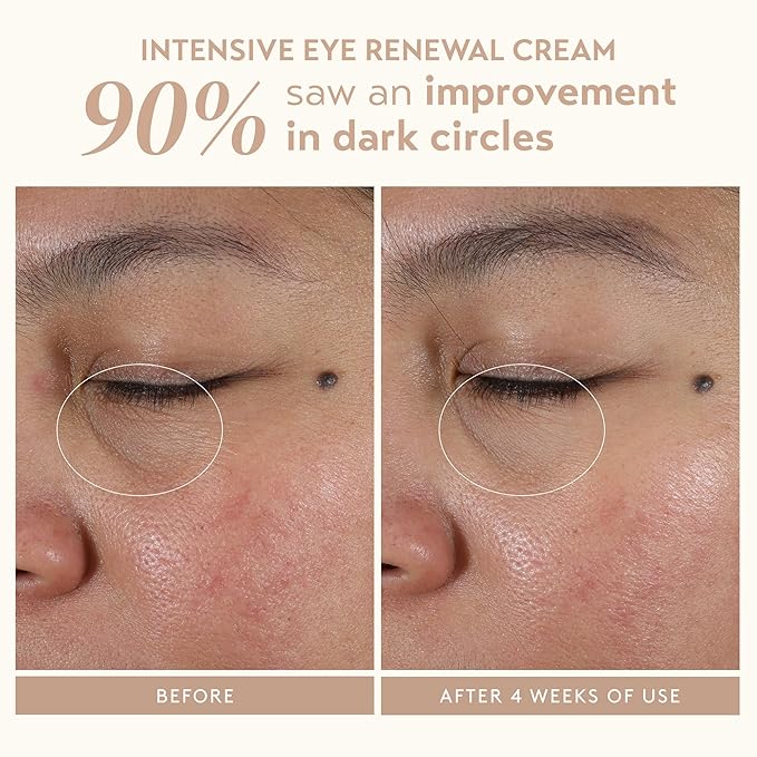 SHANI DARDEN Signature At-Home Facial Kit, Cleansing Face Serum, Face Sculpting Wand, Hydra Prep Gel, Facial Mask and Intensive Under Eye Cream for Wrinkles and Fine Lines