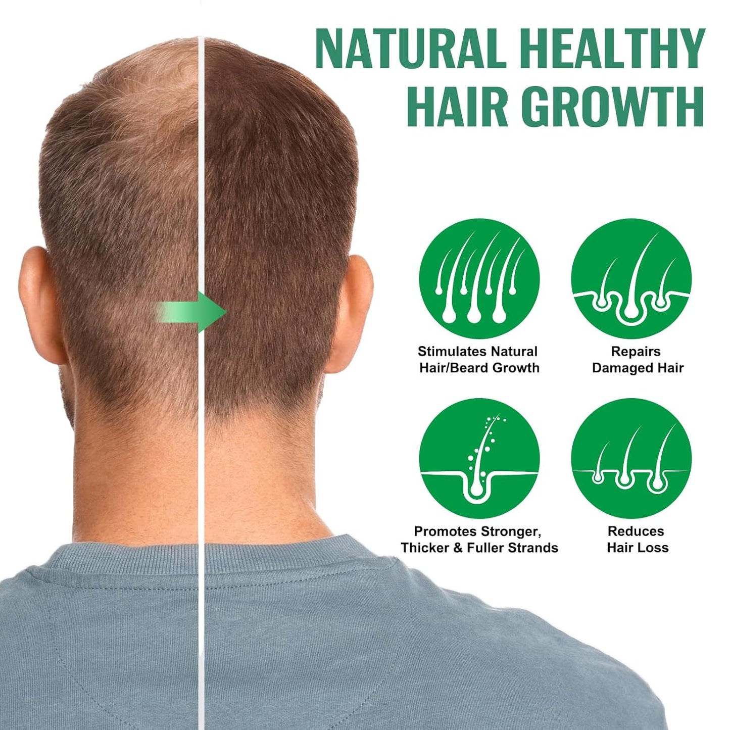 Hair Growth Spray, 2 Pack Natural Hair Growth Oil Spray With Biotin, Batana, Rosemary, and Castor Oil, Caffeine Ginseng Support Scalp Care Treatment, Thinning Hair Regrowth Thickening, Reduce damage