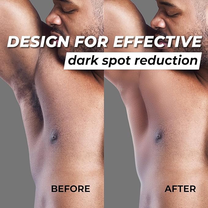 Combo exclusively for men Abera Eye Roller Serum With Mint Essence - Abera Armpit Roller