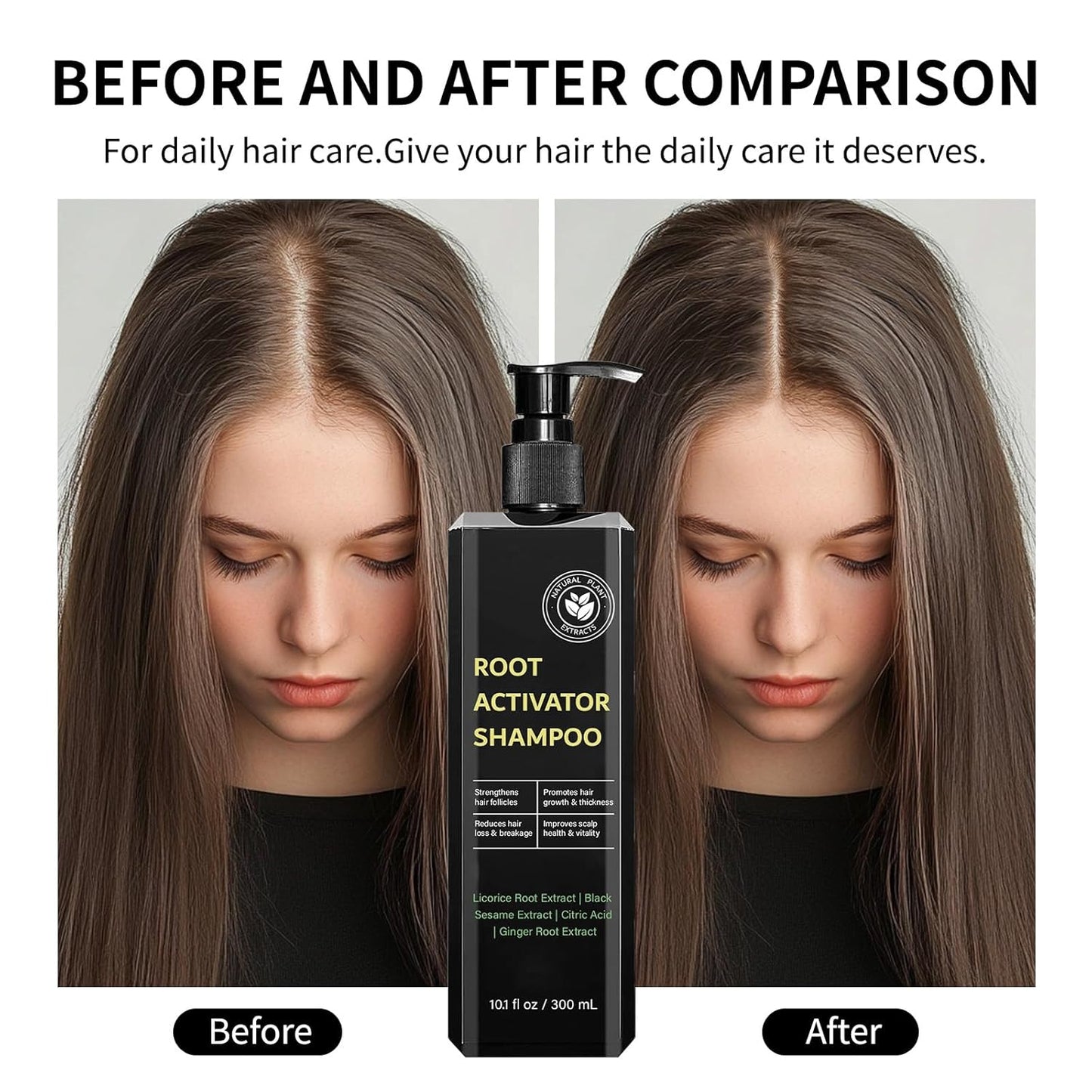 Root Activator Shampoo for Men & Women - Anti Hair Loss & Mens Hair Regrowth Shampoo with Natural Herbal Ingredients & Biotin - For Scalp Health & Cooling Sensation, 10.1 Fl Oz /300ml