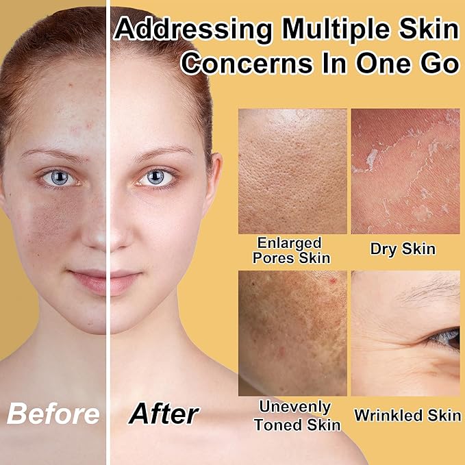 Lifting & Firming Anti-Aging Skin Care Set Kit for Women Teens,Niacinamide Retinol Serum,Hyaluronic Acid Serum,Skincare Gift Set,Facial Skin Care Products,Face Care Routine Kit Christmas Gift Women