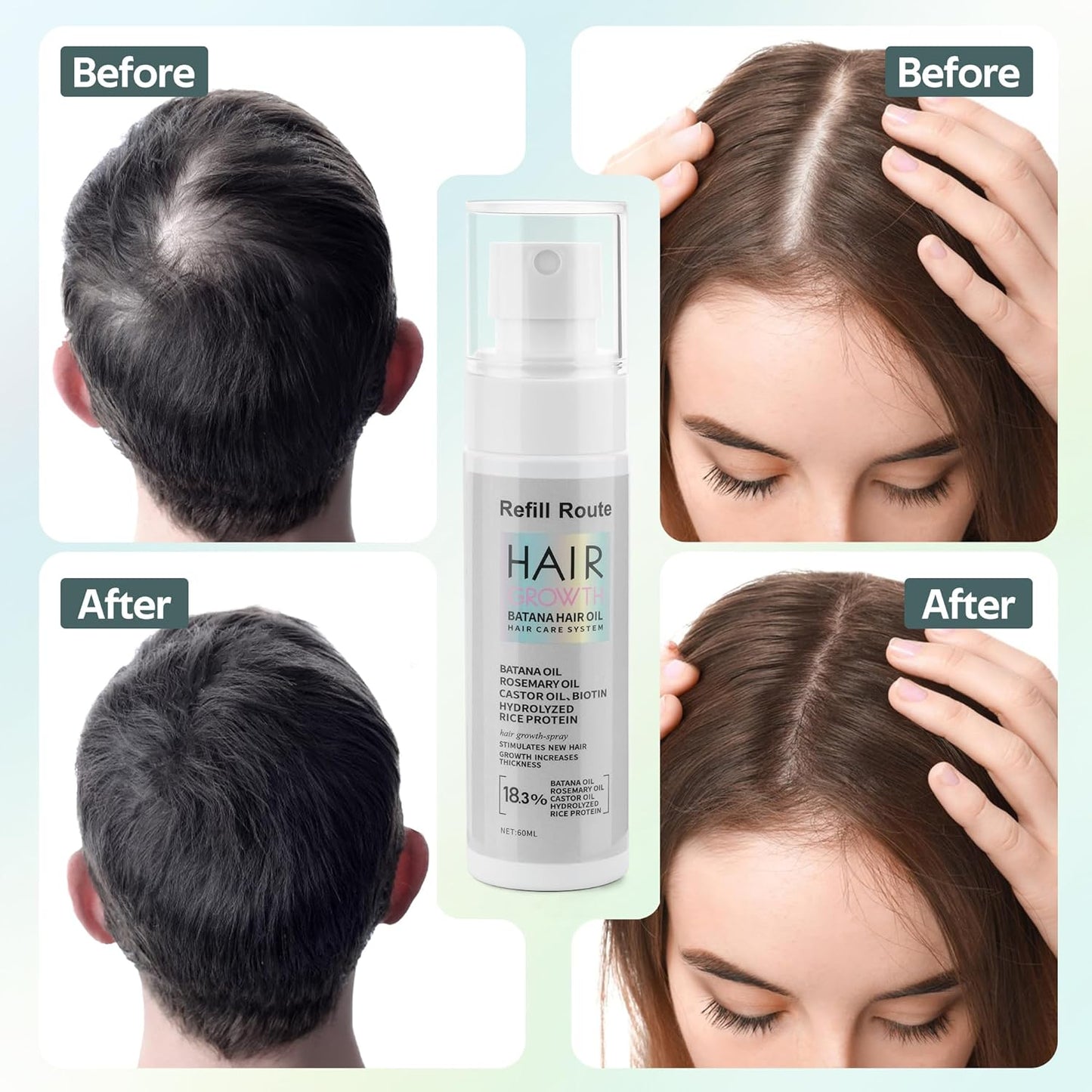 Batana Oil for Hair Growth Spray - Natural Raw Batana Oil Hair Regrowth Treatment for Women/Men with Rice Water, Biotin, Castor, Rosemary for Thicker, Stronger Hair - Vegan Hair Growth Spray