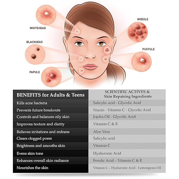 Best Acne Treatment for Face with Vitamin C for Men & Women. Use Acne Spot Treatment for Face for a Clear & Fresh Skin without Breakouts, Redness, Blemishes or Acne Scars. Results in 4 Weeks - 1 Fl Oz