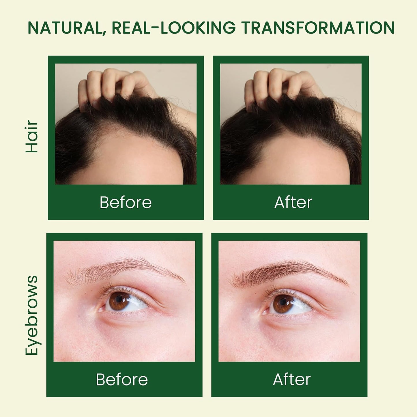 Pure Castor Oil - Cold Pressed 100% Castor Oil for Hair Growth, Skin, Eyebrows, Eye Lashes, Nails & Cuticles - Hexane Free, Natural & Unrefined - Includes Dual Mascara, Dropper & Scalp Massager