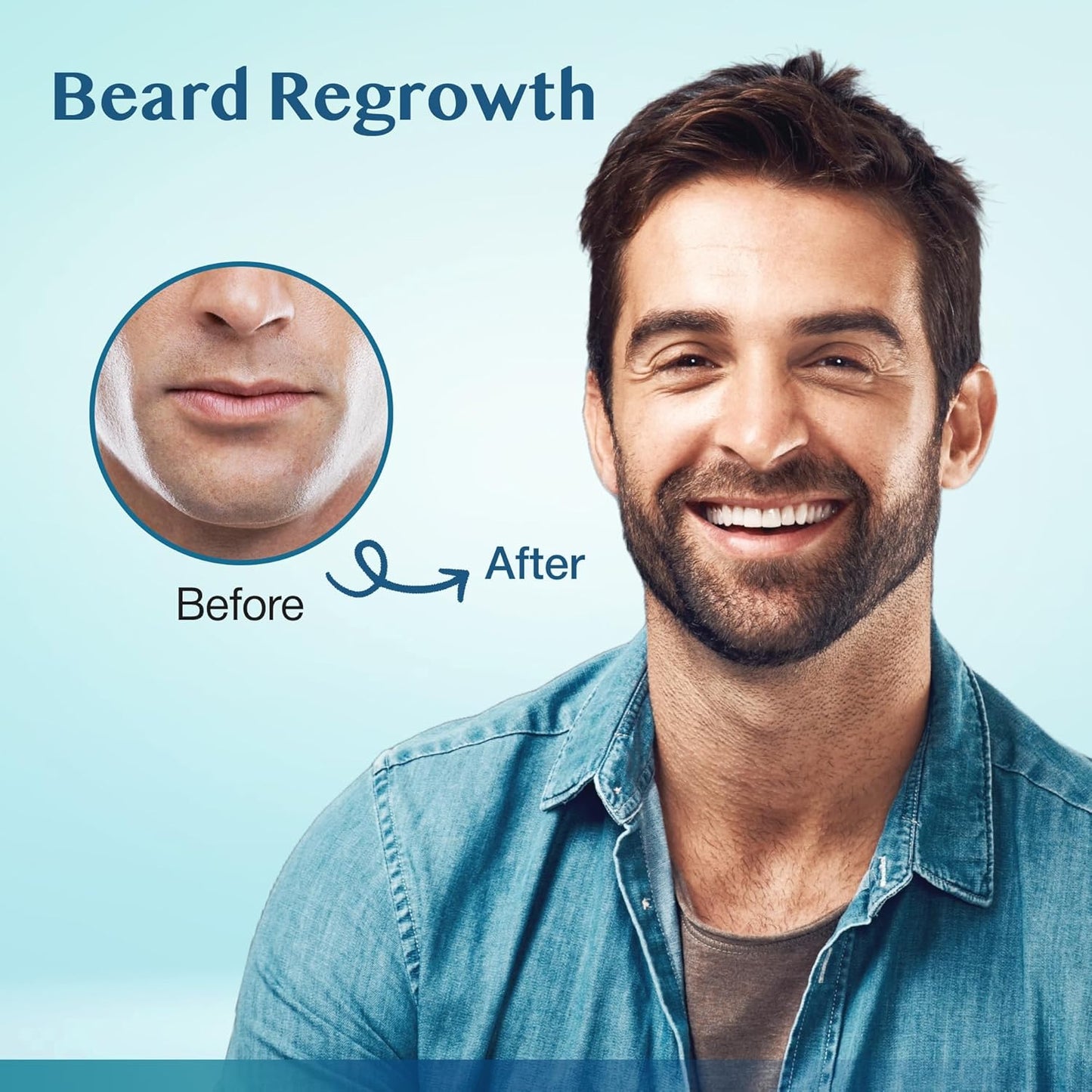 5% Minoxidil Hair Growth for Men and Women: Extra Strength Beard Regrowth Treatment Serum with Minoxidil and Biotin for Thinning Hair Loss to Grow Thicker Fuller 60ml 3 Bottles