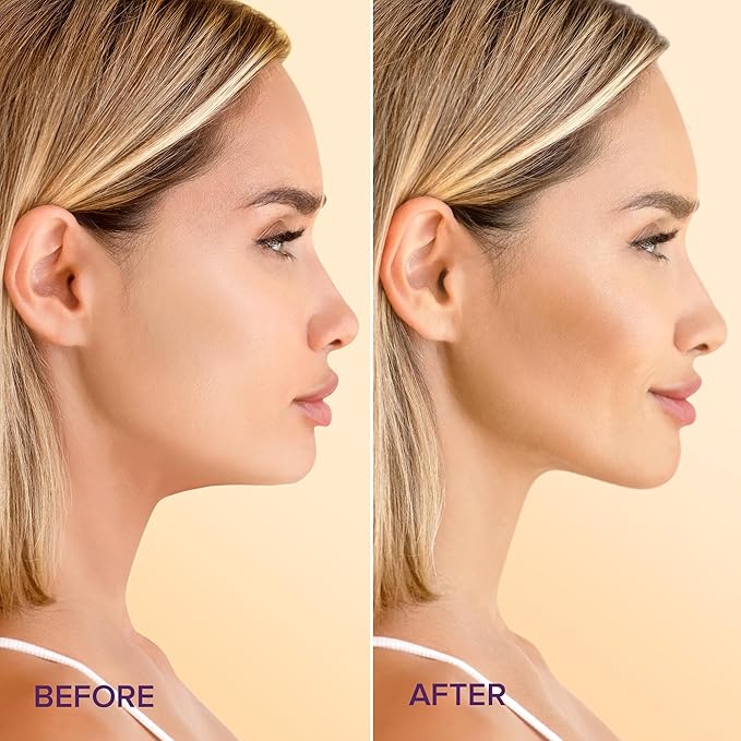 MAREE V Line Lifting Mask with 24K Gold - Deep Collagen Jawline Shaper Mask with Retinol for Face Lift - Facial Skincare Chin Strap - Hyaluronic Acid, Vitamin E - 5 Count