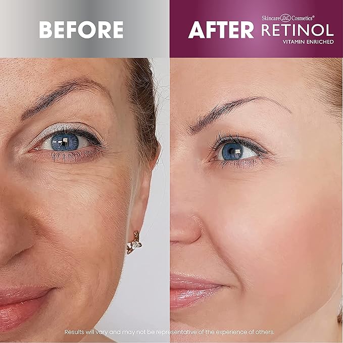 Retinol Super Face Lift - Visibly firms and tightens for a lifted, younger look. Infused, with Vitamins C & E + Retinol Eye Gel - Reduces Puffiness & Dark Circles, Restores Elasticity