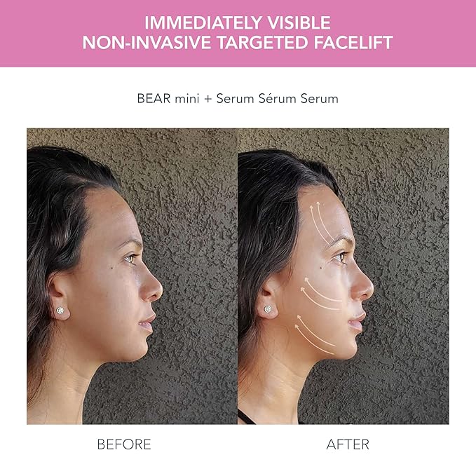 FOREO BEAR mini Microcurrent Facial Device + UFO mini 2 Face Mask Treatment + SERUM 1 fl. oz. + 6 UFO Power Activated Masks Skin Supremes Holiday Set