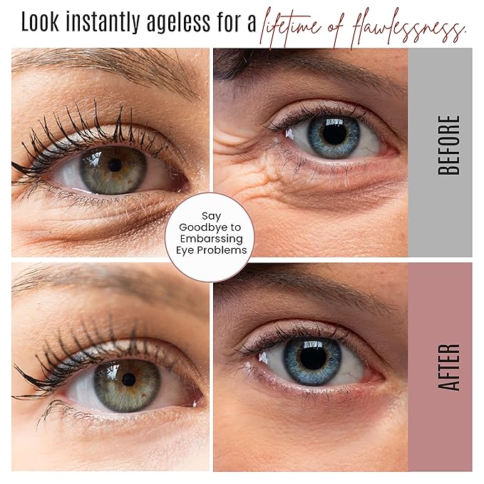 Instant Eyelift Cream Time Reverse Treatment For Dark Circles, Puffy Eyes, & Wrinkles Anti Aging Serum Reduces Under Eye Bags, Wrinkles, Dark Circles, Fine Lines & Crow's Feet Instantly - 12