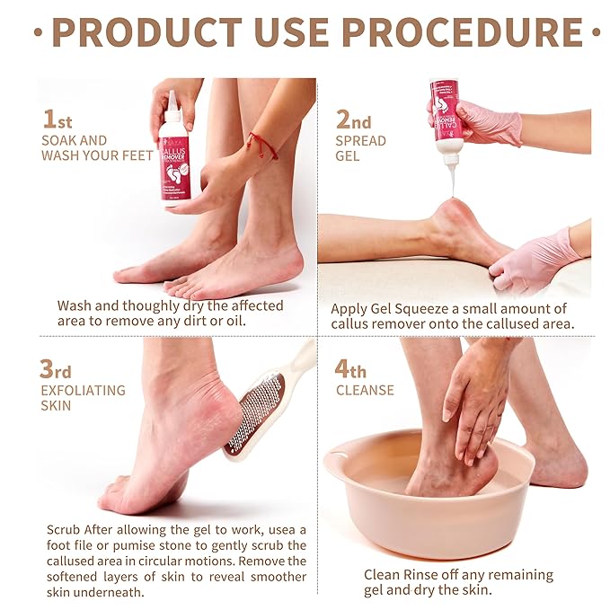 Yaya Callus Remover for Feet - Extra Strength - Vitamin E + Moisturizing Effect - Foot Scrubber File and 5 Pink Latex Gloves - Callus Remover Gel 8OZ - Foot Spa Kit